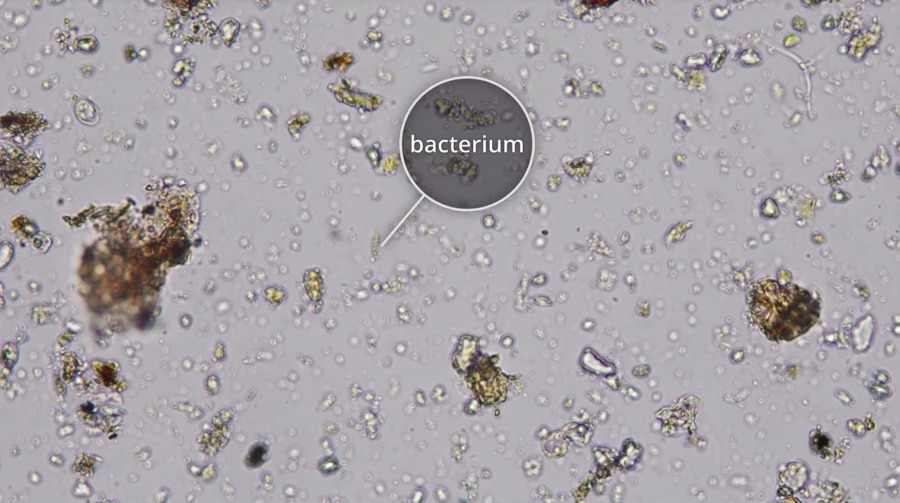 bacterium