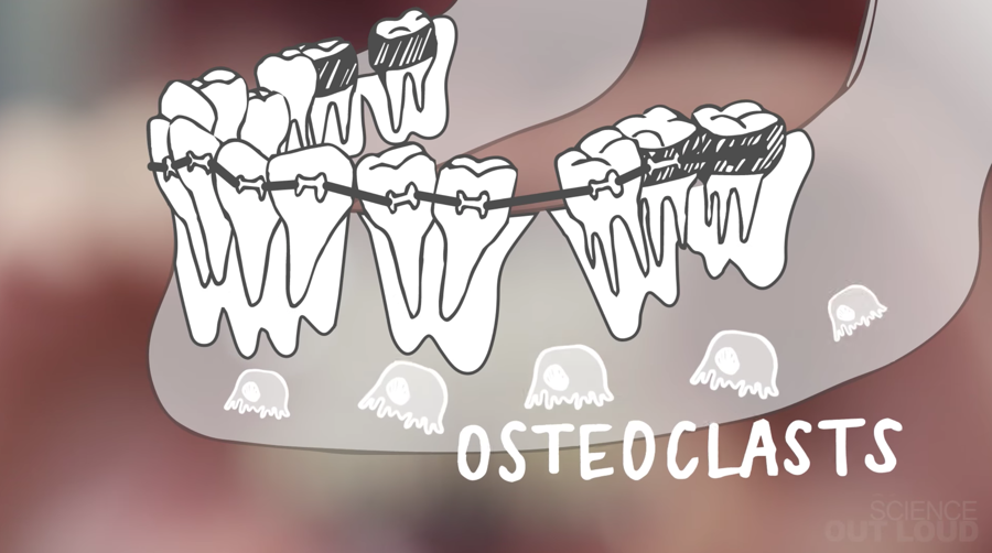 osteoclasts